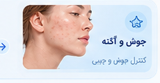 خشکی و کم‌آبی